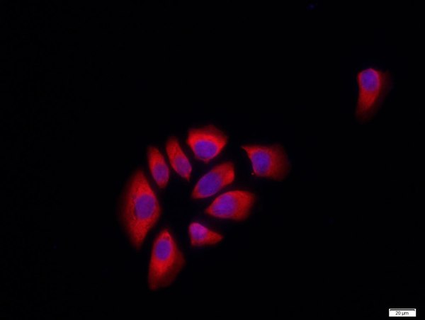 MCF-7 cells were stained with E cadherin Polyclonal Antibody, Unconjugated(bs-10009R) at 1:500 in PBS and incubated for two hours at 37°C followed by Goat Anti-Rabbit IgG (H+L) Cy3 conjugated secondary antibody. DAPI staining of the nucleus was done and then detected.