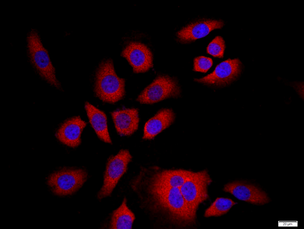 MCF-7 cells were stained with NFKB Polyclonal Antibody, Unconjugated(bs-10037R) at 1:500 in PBS and incubated for two hours at 37\u00b0C followed by Goat Anti-Rabbit IgG (H+L) Cy3 conjugated secondary antibody. DAPI staining of the nucleus was done and then detected.