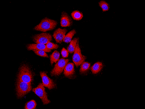 MCF-7 cells were stained with P21 Polyclonal Antibody, Unconjugated(bs-10129R) at 1:500 in PBS and incubated for two hours at 37°C followed by Goat Anti-Rabbit IgG (H+L) Cy3 conjugated secondary antibody. DAPI staining of the nucleus was done and then detected.