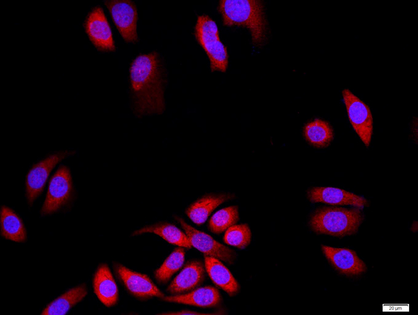 MCF-7 cells were stained with DLG1+3 Polyclonal Antibody, Unconjugated(bs-11315R) at 1:500 in PBS and incubated for two hours at 37°C followed by Goat Anti-Rabbit IgG (H+L) Cy3 conjugated secondary antibody. DAPI staining of the nucleus was done and then detected.