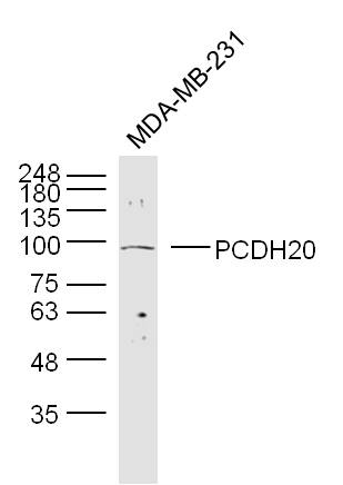 Lane 1: MDA-MB-231 cell lysates probed with \tPCDH20 Polyclonal Antibody, Unconjugated (bs-11113R) at 1:300 overnight at 4˚C. Followed by a conjugated secondary antibody at 1:10000 for 90 min at 37˚C.