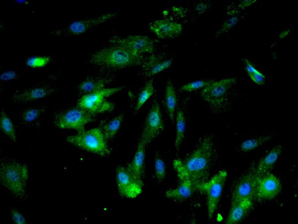 Image provided by One World Lab validation program. A7R5 cells probed with ICAM1 Polyclonal Antibody (bs-0608R) at 1:50 for 60 minutes at room temperature followed by Goat Anti-Rabbit IgG (H+L) Alexa Fluor 488 Conjugated secondary antibody.