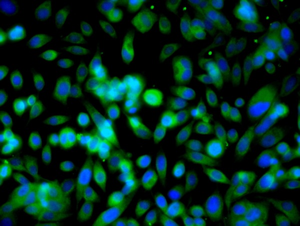 Image provided by One World Lab validation program. PC3 cells probed with Ubiquitin Polyclonal Antibody (bs-1549R) at 1:50 for 60 minutes at room temperature followed by Goat Anti-Rabbit IgG (H+L) Alexa Fluor 488 Conjugated secondary antibody.