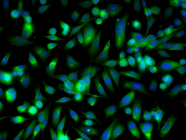 Image provided by One World Lab validation program. PC3 cells probed with SIRT5 Polyclonal Antibody (bs-9456R) at 1:50 for 60 minutes at room temperature followed by Goat Anti-Rabbit IgG (H+L) Alexa Fluor 488 Conjugated secondary antibody.