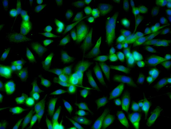 Image provided by One World Lab validation program. HEK293 cells probed with RAR Beta Polyclonal Antibody (bs-0516R) at 1:50 for 60 minutes at room temperature followed by Goat Anti-Rabbit IgG (H+L) Alexa Fluor 488 Conjugated secondary antibody.\\n