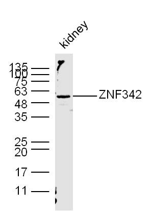 Mouse kidney lysates probed with ZNF342/ZNF296 Polyclonal Antibody, unconjugated (bs-12212R) at 1:300 overnight at 4°C followed by a conjugated secondary antibody at 1:10000 for 60 minutes at 37°C.