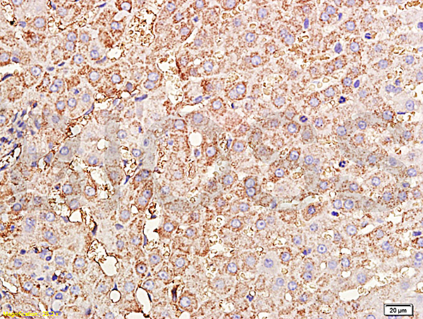 Formalin-fixed and paraffin embedded rabbit liver tissue labeled with Rabbit Anti-TIMP-1(NT) Polyclonal Antibody, Unconjugated (bs-0415R)  at 1:200 followed by conjugation to the secondary antibody and DAB staining.