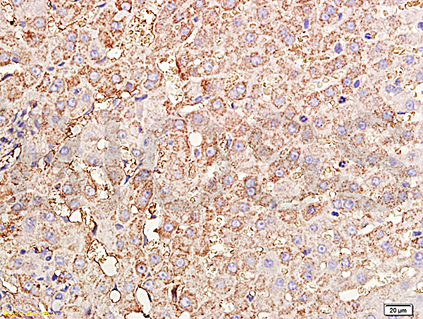 Formalin-fixed and paraffin embedded rabbit liver tissue labeled with Rabbit Anti-TIMP-1(NT) Polyclonal Antibody, Unconjugated (bs-0415R) at 1:200 followed by conjugation to the secondary antibody and DAB staining.