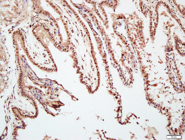 Paraformaldehyde-fixed, paraffin embedded mouse placenta; Antigen retrieval by boiling in sodium citrate buffer (pH6.0) for 15min; Block endogenous peroxidase by 3% hydrogen peroxide for 20 minutes; Blocking buffer (normal goat serum) at 37°C for 30min; Antibody incubation with TAZ Polyclonal Antibody, Unconjugated (bs-12367R) at 1:400 overnight at 4°C, followed by a conjugated secondary for 20 minutes and DAB staining. Paraformaldehyde-fixed, paraffin embedded mouse placenta; Antigen retrieval by boiling in sodium citrate buffer (pH6.0) for 15min; Block endogenous peroxidase by 3% hydrogen peroxide for 20 minutes; Blocking buffer (normal goat serum) at 37°C for 30min; Antibody incubation with TAZ Polyclonal Antibody, Unconjugated (bs-12367R) at 1:400 overnight at 4°C, followed by a conjugated secondary for 20 minutes and DAB staining.