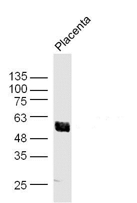 Mouse placenta lysates probed with Akt1\/3 Polyclonal Antibody, unconjugated (bs-0115M) at 1:300 overnight at 4\u00b0C followed by a conjugated secondary antibody at 1:10000 for 90 minutes at 37\u00b0C.