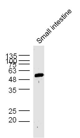 Mouse small intestine lysates probed with AP1M2 Polyclonal Antibody, unconjugated (bs-13638R) at 1:300 overnight at 4°C followed by a conjugated secondary antibody at 1:10000 for 60 minutes at 37°C.
