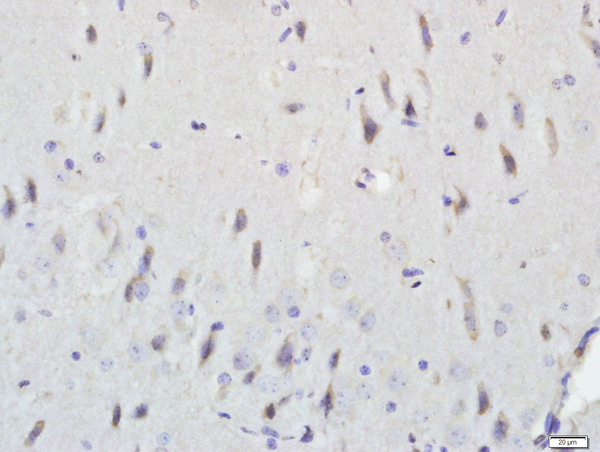 Paraformaldehyde-fixed, paraffin embedded rat brain; Antigen retrieval by boiling in sodium citrate buffer (pH6.0) for 15min; Block endogenous peroxidase by 3% hydrogen peroxide for 20 minutes; Blocking buffer (normal goat serum) at 37°C for 30min; Antibody incubation with PDE7B Polyclonal Antibody, Unconjugated (bs-11576R) at 1:500 overnight at 4°C, followed by a conjugated secondary (sp-0023) for 20 minutes and DAB staining