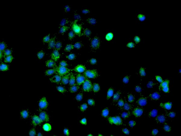 Image provided by One World Lab validation program. A431 cells probed with ERK1 Polyclonal Antibody (bs-1020R) at 1:50 for 60 minutes at room temperature followed by Goat Anti-Rabbit IgG (H+L) Alexa Fluor 488 Conjugated secondary antibody.