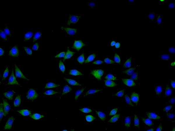 Image provided by One World Lab validation program. SMMC7721 cells probed with ERK1 Polyclonal Antibody (bs-1020R) at 1:50 for 60 minutes at room temperature followed by Goat Anti-Rabbit IgG (H+L) Alexa Fluor 488 Conjugated secondary antibody.