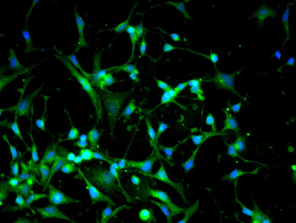 Image provided by One World Lab validation program. SH-SY5Y cells probed with Dnmt3a Polyclonal Antibody (bs-0497R) at 1:50 for 60 minutes at room temperature followed by Goat Anti-Rabbit IgG (H+L) Alexa Fluor 488 Conjugated secondary antibody.