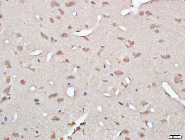 Paraformaldehyde-fixed, paraffin embedded rat brain; Antigen retrieval by boiling in sodium citrate buffer (pH6.0) for 15min; Block endogenous peroxidase by 3% hydrogen peroxide for 20 minutes; Blocking buffer (normal goat serum) at 37°C for 30min; Antibody incubation with Gelsolin Polyclonal Antibody, Unconjugated (bs-1160R) at 1:400 overnight at 4°C, followed by a conjugated secondary for 20 minutes and DAB staining.