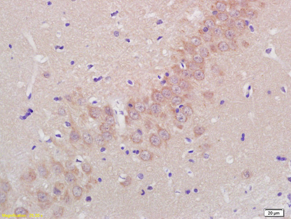 Formalin-fixed and paraffin embedded rat brain labeled with Rabbit Anti Aggrecanase-2/ADAMTS5 Polyclonal Antibody, Unconjugated (bs-3573R) at 1:200 followed by conjugation to the secondary antibody and DAB staining