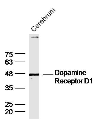 Mouse cerebrum lysates probed with DRD1 Polyclonal Antibody, unconjugated (bs-1007R) at 1:300 overnight at 4°C followed by a conjugated secondary antibody at 1:10000 for 90 minutes at 37°C.