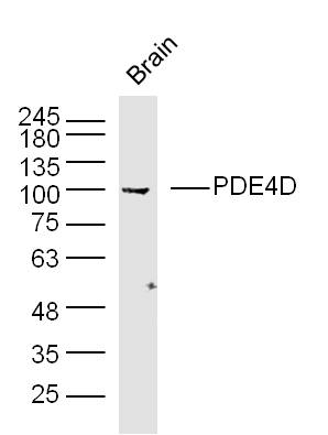 Mouse brain lysates probed with PDE4D Polyclonal Antibody, unconjugated (bs-1325R) at 1:300 overnight at 4°C followed by a conjugated secondary antibody at 1:10000 for 90 minutes at 37°C.