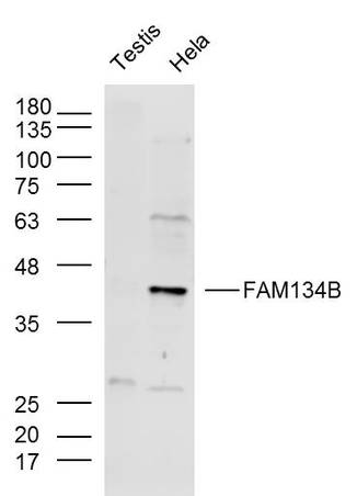 Lane 1: Mouse testis lysates; Lane 2: Hela lysates probed with FAM134B Polyclonal Antibody, Unconjugated (bs-13136R) at 1:300 overnight at 4˚C. Followed by a conjugated secondary antibody at 1:10000 for 60 min at 37˚C.
