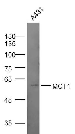 Lane 1: A431 lysates; probed with MCT1 Polyclonal Antibody, Unconjugated (bs-10249R) at 1:300 overnight at 4˚C. Followed by a conjugated secondary antibody at 1:10000 for 60 min at 37˚C. Lane 1: A431 lysates; probed with MCT1 Polyclonal Antibody, Unconjugated (bs-10249R) at 1:300 overnight at 4˚C. Followed by a conjugated secondary antibody at 1:10000 for 60 min at 37˚C.