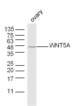 Mouse ovary lysates probed with WNT5A Polyclonal Antibody, unconjugated (bs-1948R) at 1:300 overnight at 4\u00b0C followed by a conjugated secondary antibody at 1:10000 for 90 minutes at 37\u00b0C.