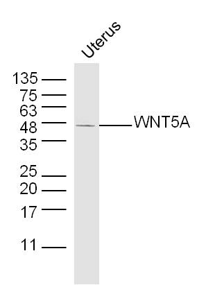 Mouse uterus lysates probed with WNT5A Polyclonal Antibody, unconjugated (bs-1948R) at 1:300 overnight at 4°C followed by a conjugated secondary antibody at 1:10000 for 90 minutes at 37°C.