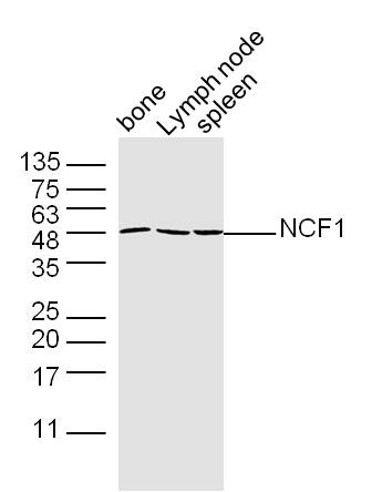 Mouse bone, lymph node, and spleen lysates probed with Polyclonal Antibody, unconjugated (bs-3886R) at 1:300 overnight at 4°C followed by a conjugated secondary antibody at 1:10000 for 90 minutes at 37°C.