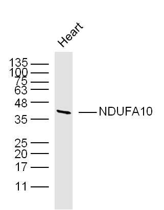 Mouse heart lysates probed with NDUFA10 Polyclonal Antibody, unconjugated (bs-3957R) at 1:300 overnight at 4°C followed by a conjugated secondary antibody at 1:10000 for 90 minutes at 37°C.