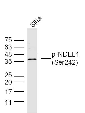Human Siha cell lysates probed with NDEL1 (Ser242) Polyclonal Antibody, unconjugated (bs-5523R) at 1:300 overnight at 4°C followed by a conjugated secondary antibody at 1:10000 for 90 minutes at 37°C.