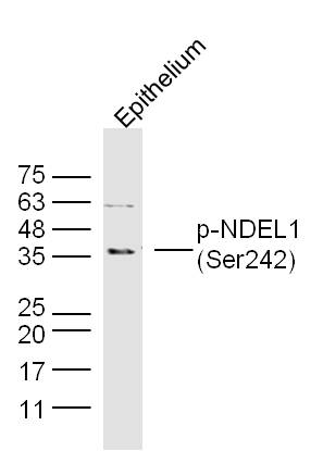 Mouse epithelium lysates probed with NDEL1 (Ser242) Polyclonal Antibody, unconjugated (bs-5523R) at 1:300 overnight at 4°C followed by a conjugated secondary antibody at 1:10000 for 90 minutes at 37°C.