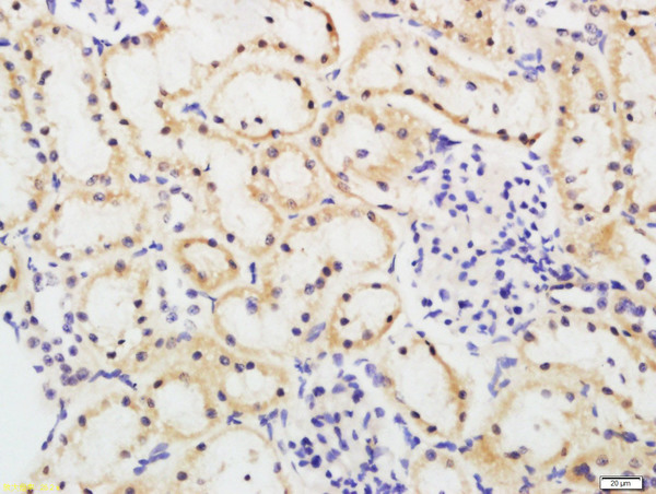 Formalin-fixed and paraffin embedded mouse kidney tissue labeled with FBXO42 Polyclonal Antibody, Unconjugated (bs-10560R) at 1:200 followed by conjugation to the secondary antibody and DAB staining