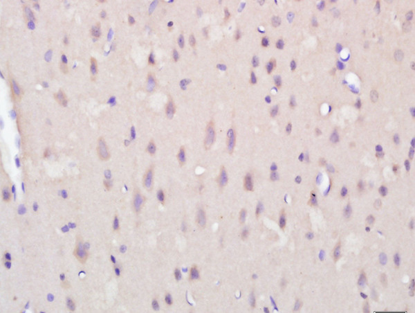 Formalin-fixed and paraffin embedded rat brain tissue labeled with KCTD19 Polyclonal Antibody, Unconjugated (bs-16930R) at 1:200 followed by conjugation to the secondary antibody and DAB staining