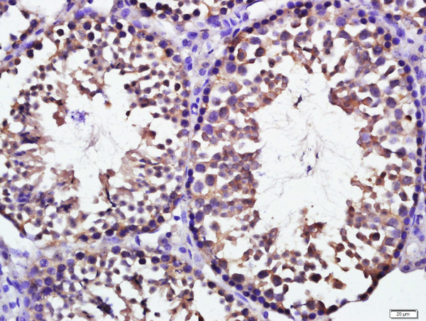 Formalin-fixed and paraffin embedded mouse testis tissue labeled with KCTD19 Polyclonal Antibody, Unconjugated (bs-16930R) at 1:200 followed by conjugation to the secondary antibody and DAB staining