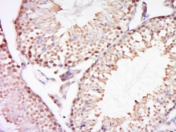 Formalin-fixed and paraffin embedded mouse testis tissue labeled with REV3L Polyclonal Antibody, Unconjugated (bs-19840R) at 1:200 followed by conjugation to the secondary antibody and DAB staining
