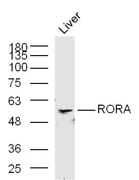 Mouse liver lysates probed with RORA Polyclonal Antibody, Unconjugated (bs-17164R) at 1:300 in 4˚C overnight. Followed by conjugation to secondary antibody (bs-0295G-HRP) at 1:5000 for 90min at 37˚C.