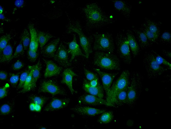 Validation submitted by One World Lab. MCF-7 cells were stained with COX4 Polyclonal Antibody, Unconjugated\uff0cbs-10257R at 1:50 in PBS and incubated for one hour at room temperature, followed by secondary antibody incubation, DAPI staining of the nuclei and detection.