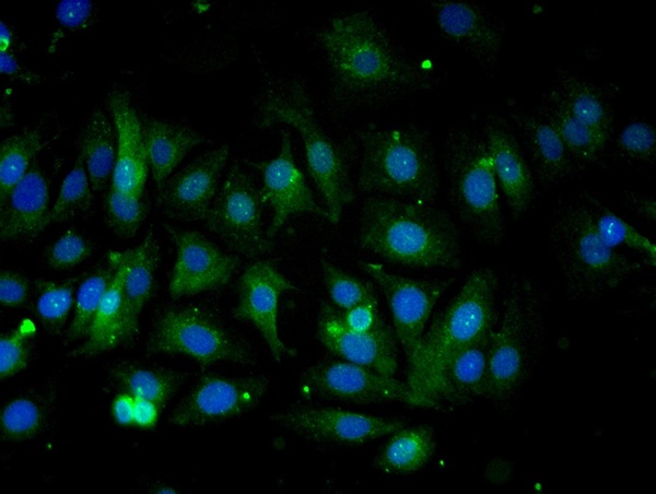 Validation submitted by One World Lab. MCF-7 cells were stained with COX4 Polyclonal Antibody, Unconjugated，bs-10257R at 1:50 in PBS and incubated for one hour at room temperature, followed by secondary antibody incubation, DAPI staining of the nuclei and detection.