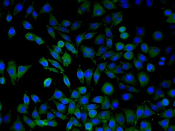 SMMC7721 cells were stained with ARMC3 Polyclonal Antibody, Unconjugated (bs-7969R) at 1:50 in PBS and incubated for one hour at room temperature, followed by secondary antibody incubation, DAPI staining of the nuclei and detection.