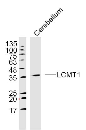 Mouse cerebellum lysates probed with LCMT1 Polyclonal Antibody, unconjugated (bs-6249R) at 1:300 overnight at 4°C followed by a conjugated secondary antibody at 1:10000 for 90 minutes at 37°C.