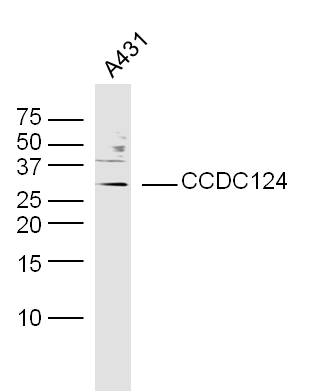 Human A431 cells probed with CCDC124 Polyclonal Antibody, unconjugated (bs-8083R) at 1:300 overnight at 4°C followed by a conjugated secondary antibody at 1:10000 for 90 minutes at 37°C.