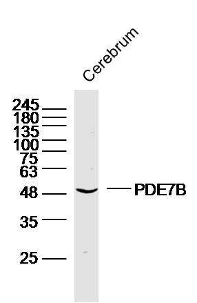 Mouse cerebrum lysates probed with PDE7B Polyclonal Antibody, unconjugated (bs-11576R) at 1:300 overnight at 4°C followed by a conjugated secondary antibody at 1:10000 for 90 minutes at 37°C.