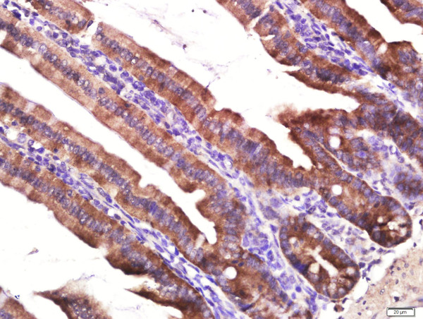 Paraformaldehyde-fixed, paraffin embedded Mouse small intestine tissue; Antigen retrieval by boiling in sodium citrate buffer(pH6) for 15min; Block endogenous peroxidase by 3% hydrogen peroxide for 20 minutes; Blocking buffer (normal goat serum) at 37°C for 30min; Antibody incubation with Layilin Polyclonal Antibody, Unconjugated (bs-4629R) at 1:400 overnight at 4°C, followed by a conjugated secondary and DAB staining