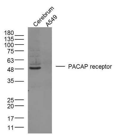 Mouse brain lysates and Human A549 cells probed with PACAP receptor 1 Polyclonal Antibody, unconjugated (bs-0198R) at 1:300 overnight at 4°C followed by a conjugated secondary antibody at 1:10000 for 90 minutes at 37°C.