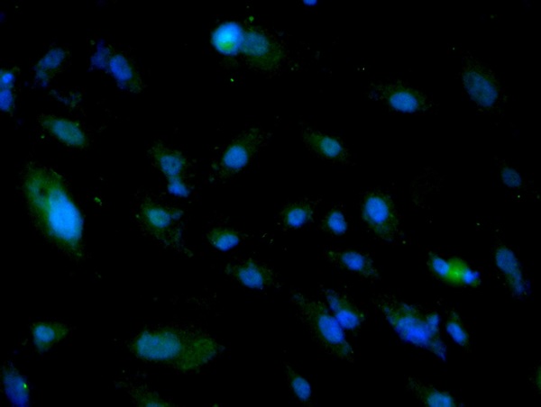 Image obtained from One World Lab validations program. A549 cells were stained with ALDH1 Polyclonal Antibody, Unconjugated (bs-10162R) at 1:50 in PBS and incubated for one hour at room temperature, followed by secondary antibody incubation, DAPI staining of the nuclei and detection.