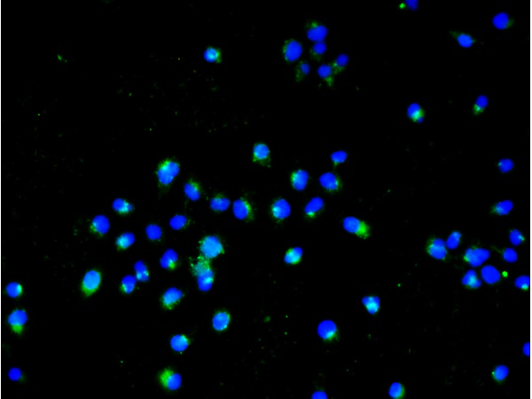 Image obtained from One World Lab validations program. A431 cells were stained with PTP zeta Polyclonal Antibody, Unconjugated (bs-11327R) at 1:50 in PBS and incubated for one hour at room temperature, followed by secondary antibody incubation, DAPI staining of the nuclei and detection.