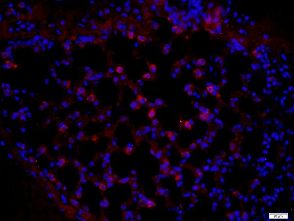 Pan Cytokeratin/p-CK Polyclonal Antibody – Bioss