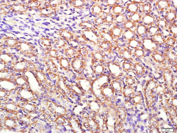 Paraformaldehyde-fixed, paraffin embedded rat kidney tissue; Antigen retrieval by boiling in sodium citrate buffer(pH6) for 15min; Block endogenous peroxidase by 3% hydrogen peroxide for 30 minutes; Blocking buffer (normal goat serum) at 37°C for 20min; Antibody incubation with Rabbit Anti-PI3KCA Polyclonal Antibody, Unconjugated (bs-2067R) at 1:400 overnight at 4°C, followed by a conjugated secondary and DAB staining