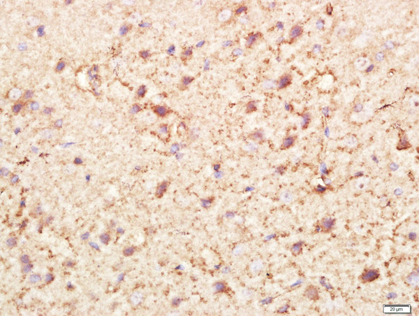 Paraformaldehyde-fixed, paraffin embedded rat brain tissue; Antigen retrieval by boiling in sodium citrate buffer(pH6) for 15min; Block endogenous peroxidase by 3% hydrogen peroxide for 30 minutes; Blocking buffer (normal goat serum) at 37°C for 20min; Antibody incubation with Rabbit Anti-PI3KCA Polyclonal Antibody, Unconjugated (bs-2067R) at 1:400 overnight at 4°C, followed by a conjugated secondary and DAB staining