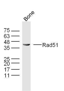 Mouse bone lysates probed with Rad51 Polyclonal Antibody, Unconjugated (bs-20297R) at 1:300 overnight at 4˚C. Followed by a conjugated secondary antibody (bs-0295G-HRP) at 1:5000 for 90 min at 37˚C. Mouse bone lysates probed with Rad51 Polyclonal Antibody, Unconjugated (bs-20297R) at 1:300 overnight at 4˚C. Followed by a conjugated secondary antibody (bs-0295G-HRP) at 1:5000 for 90 min at 37˚C.